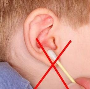 ᐈ Серная пробка в ухе у ребенка. Какие ее симптомы, и как лечить? | Медицентр (Доктор ЛОР)